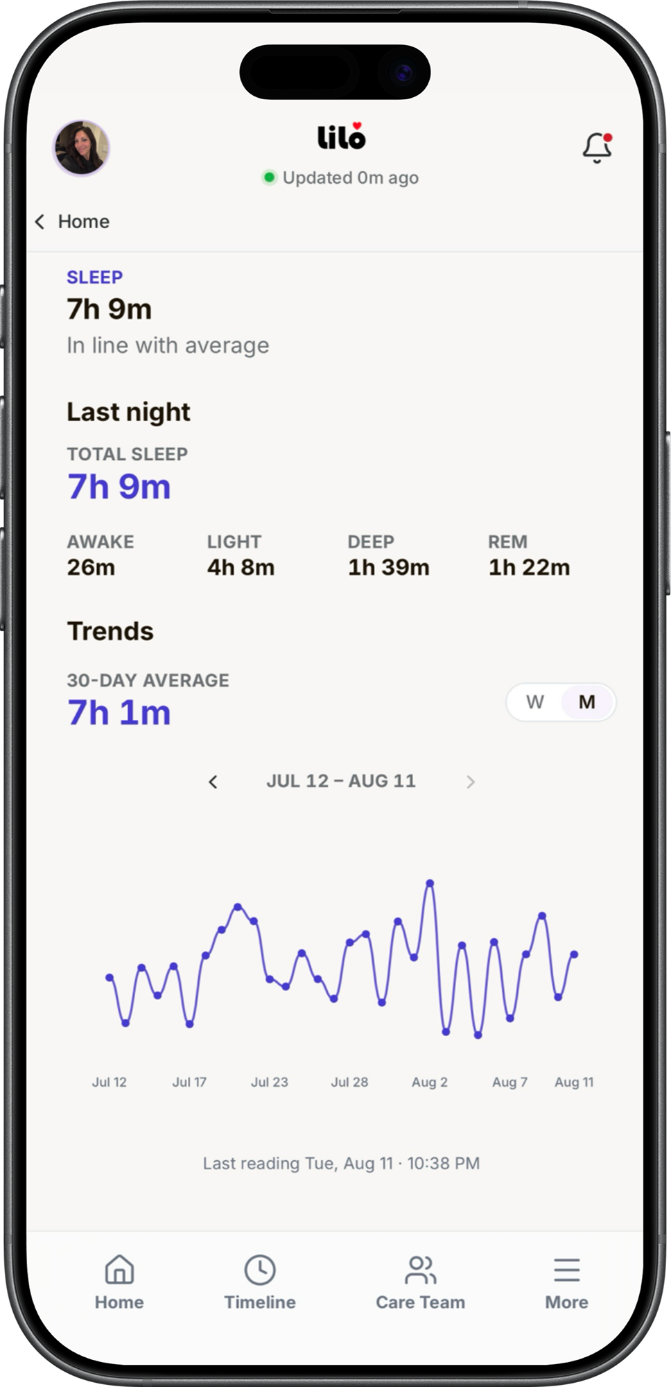 A sleep trend screen with an established baseline: thirty days of readings with a visible direction, and last night's stage breakdown beneath.